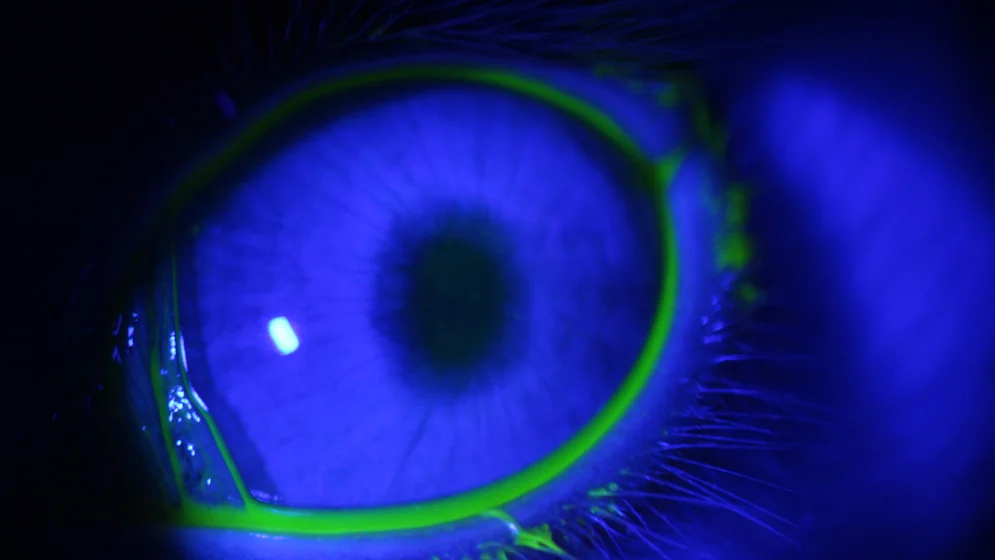 2026-09-17 CONICET - Glaucoma 01